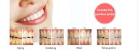 NW Calgary Dental Implants image 1